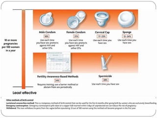 Aparato reproductor.