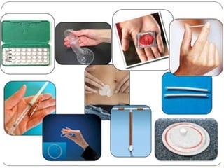 Aparato reproductor.