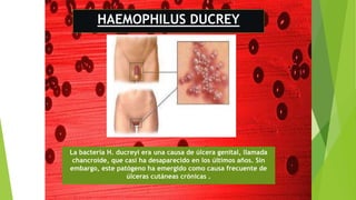 HAEMOPHILUS DUCREY
La bacteria H. ducreyi era una causa de úlcera genital, llamada
chancroide, que casi ha desaparecido en los últimos años. Sin
embargo, este patógeno ha emergido como causa frecuente de
úlceras cutáneas crónicas .
 