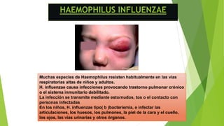 HAEMOPHILUS INFLUENZAE
Muchas especies de Haemophilus resisten habitualmente en las vías
respiratorias altas de niños y adultos.
H. influenzae causa infecciones provocando trastorno pulmonar crónico
o el sistema inmunitario debilitado.
La infección se transmite mediante estornudos, tos o el contacto con
personas infectadas
En los niños, H. influenzae tipo( b )bacteriemia, e infectar las
articulaciones, los huesos, los pulmones, la piel de la cara y el cuello,
los ojos, las vías urinarias y otros órganos.
 
