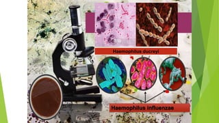 Haemophilus ducreyi
Haemophilus influenzae
 