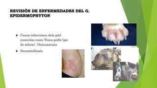 REVISIÓN DE ENFERMEDADES DEL G.
EPIDERMOPHYTON
 Causa infecciones dela piel
conocidas como Tinea pedís (pie
de atleta) , Onicomicosis
 Dermatofitosis
 