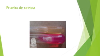Prueba de ureasa
 
