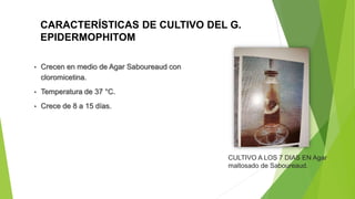CARACTERÍSTICAS DE CULTIVO DEL G.
EPIDERMOPHITOM
• Crecen en medio de Agar Saboureaud con
cloromicetina.
• Temperatura de 37 °C.
• Crece de 8 a 15 días.
CULTIVO A LOS 7 DIAS EN Agar
maltosado de Saboureaud.
 