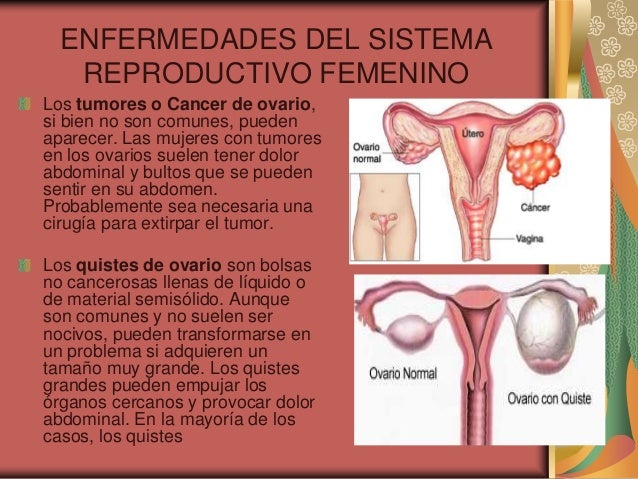 Aparato Reproductor Femenino y Masculino
