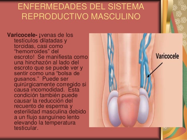 Que se acercará la pose con un pequeño miembro