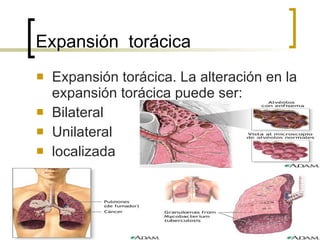 Expansión  torácica Expansión torácica. La alteración en la expansión torácica puede ser: Bilateral Unilateral localizada 