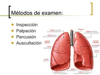 Métodos de examen: Inspección Palpación Percusión Auscultación 