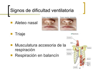 Signos de dificultad ventilatoria Aleteo nasal Triaje Musculatura accesoria de la respiración Respiración en balancín 