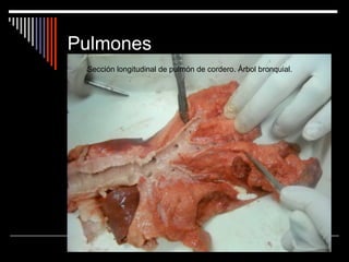 Pulmones
 Sección longitudinal de pulmón de cordero. Árbol bronquial.
 