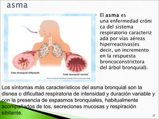    El asma es
                                              una enfermedad cróni
                                              ca del sistema
                                              respiratorio caracteriz
                                              ada por vías aéreas
                                              hiperreactivas(es
                                              decir, un incremento
                                              en la respuesta
                                              broncoconstrictora
                                              del árbol bronquial).



Los síntomas más característicos del asma bronquial son la
disnea o dificultad respiratoria de intensidad y duración variable y
con la presencia de espasmos bronquiales, habitualmente
acompañados de tos, secreciones mucosas y respiración
sibilante.                                                         27
 