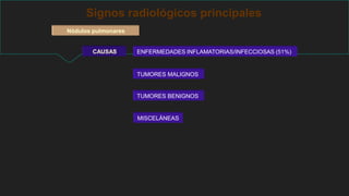 Signos radiológicos principales
CAUSAS
Nódulos pulmonares
ENFERMEDADES INFLAMATORIAS/INFECCIOSAS (51%)
TUMORES MALIGNOS
TUMORES BENIGNOS
MISCELÁNEAS
 