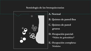 Semiología de las bronquiectasias
A
A. Normal
B
C
D
E
A. Normal
B. Quistes de pared fina
A. Normal
B. Quistes de pared fina
C. Quistes de pared
gruesa
A. Normal
B. Quistes de pared fina
C. Quistes de pared
gruesa
D. Ocupación parcial:
“Nidos de golondrina”
A. Normal
B. Quistes de pared fina
C. Quistes de pared
gruesa
D. Ocupación parcial:
“Nidos de golondrina”
E. Ocupación completa:
Nódulos
 