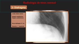 Radiología de tórax normal
2- Diafragma
Límite inferior del tx
Ángulo costofrénico
Ángulo cardiofrénico
Excur.diafragm.3-7 cm
Derecho + ↑ izquierdo
 