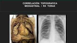 CORRELACIÓN TOPOGRAFICA
MEDIASTINAL / RX TORAX
 
