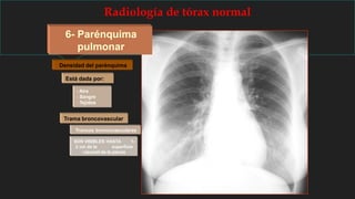 Radiología de tórax normal
6- Parénquima
pulmonar
Densidad del parénquima
Está dada por:
- Aire
- Sangre
- Tejidos
Trama broncovascular
Troncos broncovasculares
SON VISIBLES HASTA 1-
2 cm de la superficie
visceral de la pleura
 