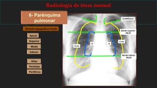 Radiología de tórax normal
6- Parénquima
pulmonar
División topográfica Frente
Apical
Superior
Media
Inferior
Hiliar
Perihiliar
Periférica
CLAVÍCULA
Borde superior
HILIO
Borde inferior
HILIO
H H
4 cm
4 cm
 