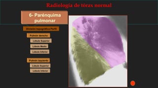 Radiología de tórax normal
6- Parénquima
pulmonar
División topográfica Perfil
Lóbulo Superior
Lóbulo Medio
Lóbulo Inferior
Pulmón derecho
Pulmón izquierdo
Lóbulo Superior
Lóbulo Inferior
 
