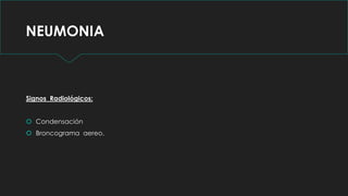 NEUMONIA
Signos Radiológicos:
 Condensación
 Broncograma aereo.
 
