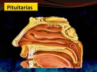 Pituitarias
 