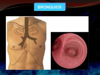 BRONQUIOS
 