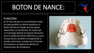 BOTON DE NANCE:
FUNCIÓN:
En el caso de que en una dentición mixta
se haya perdido un diente posterior, el
botón de Nance i...