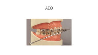 AEO
 