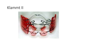 Klammt II
 