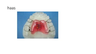 haas
 