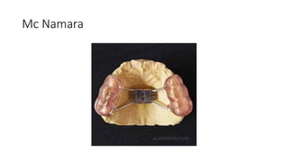 Mc Namara
 