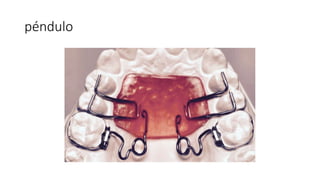 péndulo
 