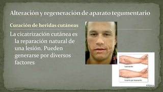 Curación de heridas cutáneas

La cicatrización cutánea es
la reparación natural de
una lesión. Pueden
generarse por diversos
factores

 