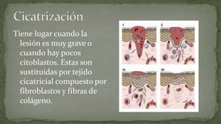 Tiene lugar cuando la
lesión es muy grave o
cuando hay pocos
citoblastos. Estas son
sustituidas por tejido
cicatricial compuesto por
fibroblastos y fibras de
colágeno.

 
