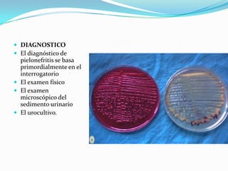  DIAGNOSTICO
 El diagnóstico de
  pielonefritis se basa
  primordialmente en el
  interrogatorio
 El examen físico
 El examen
  microscópico del
  sedimento urinario
 El urocultivo.
 