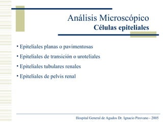 Análisis Microscópico
Células epiteliales
• Epiteliales planas o pavimentosas
• Epiteliales de transición o uroteliales
• Epiteliales tubulares renales
• Epiteliales de pelvis renal

Hospital General de Agudos Dr. Ignacio Pirovano - 2005

 