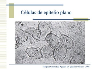 Células de epitelio plano

Hospital General de Agudos Dr. Ignacio Pirovano - 2005

 
