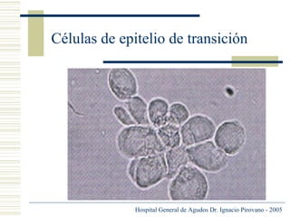 Células de epitelio de transición

Hospital General de Agudos Dr. Ignacio Pirovano - 2005

 