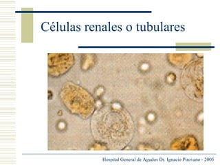 Células renales o tubulares

Hospital General de Agudos Dr. Ignacio Pirovano - 2005

 