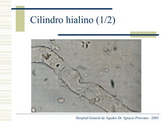Cilindro hialino (1/2)

Hospital General de Agudos Dr. Ignacio Pirovano - 2005

 
