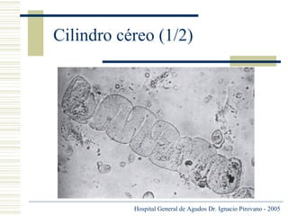 Cilindro céreo (1/2)

Hospital General de Agudos Dr. Ignacio Pirovano - 2005

 