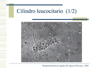 Cilindro leucocitario (1/2)

Hospital General de Agudos Dr. Ignacio Pirovano - 2005

 