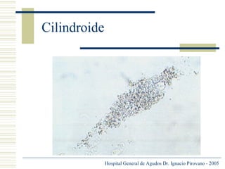 Cilindroide

Hospital General de Agudos Dr. Ignacio Pirovano - 2005

 
