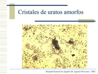 Cristales de uratos amorfos

Hospital General de Agudos Dr. Ignacio Pirovano - 2005

 