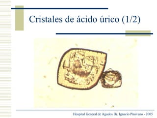 Cristales de ácido úrico (1/2)

Hospital General de Agudos Dr. Ignacio Pirovano - 2005

 