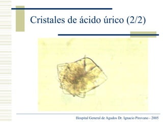 Cristales de ácido úrico (2/2)

Hospital General de Agudos Dr. Ignacio Pirovano - 2005

 