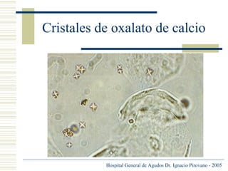 Cristales de oxalato de calcio

Hospital General de Agudos Dr. Ignacio Pirovano - 2005

 