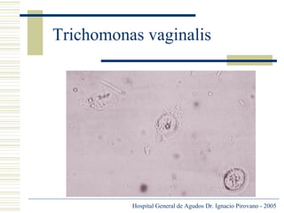 Trichomonas vaginalis

Hospital General de Agudos Dr. Ignacio Pirovano - 2005

 