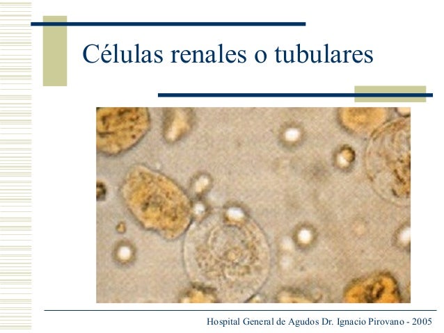 Celulas Del Tubulo Renal En Orina