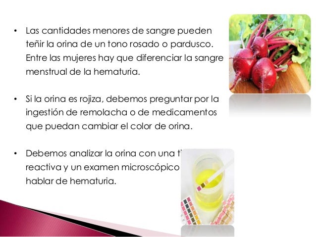 Como pasa la operación a las hernias intervertebrales