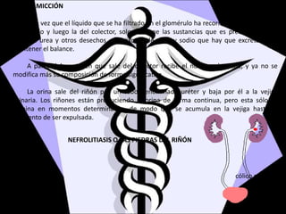 LA MICCIÓN
Una vez que el líquido que se ha filtrado en el glomérulo ha recorrido toda la longitud
del túbulo y luego la del colector, solo contiene las sustancias que es preciso eliminar,
como la urea y otros desechos, y el exceso de agua y sodio que hay que excretar para
mantener el balance.
A partir del punto en que sale del colector recibe el nombre de orina, y ya no se
modifica más su composición de forma significativa.
La orina sale del riñón por un tubo denominado uréter y baja por él a la vejiga
urinaria. Los riñones están produciendo la orina de forma continua, pero esta sólo se
elimina en momentos determinados, de modo que se acumula en la vejiga hasta el
momento de ser expulsada.
NEFROLITIASIS O LAS PIEDRAS DEL RIÑÓN
cólico nefrítico
 